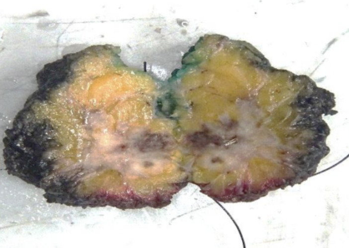 Description of the image